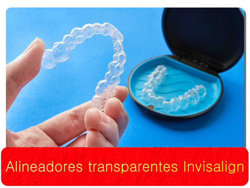 Alineadores transparentes Invisalign