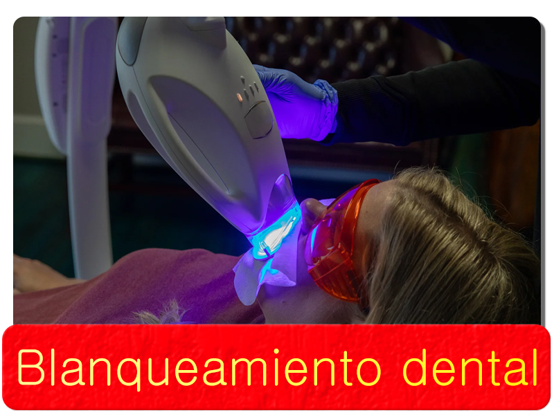 Blanqueamiento dental