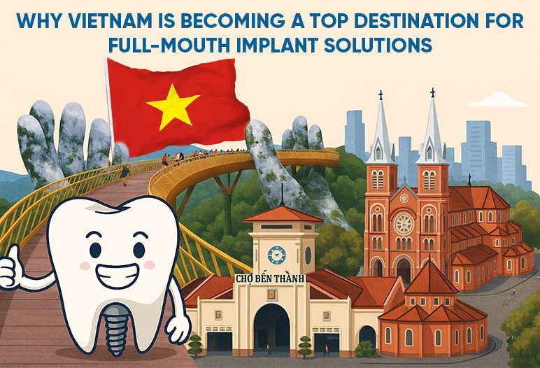 Why Vietnam is becoming a top destination for full mouth implant solutions