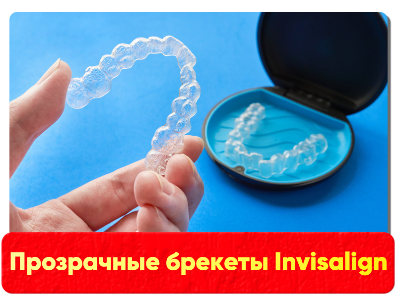 Прозрачные брекеты Invisalign