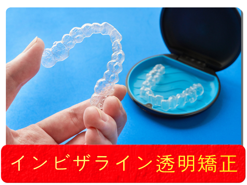 インビザライン透明矯正