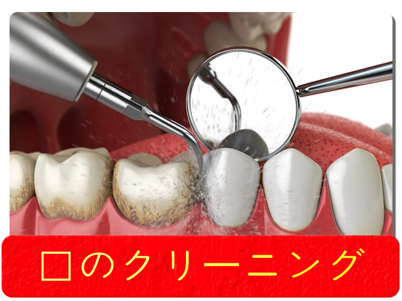 歯のクリーニング