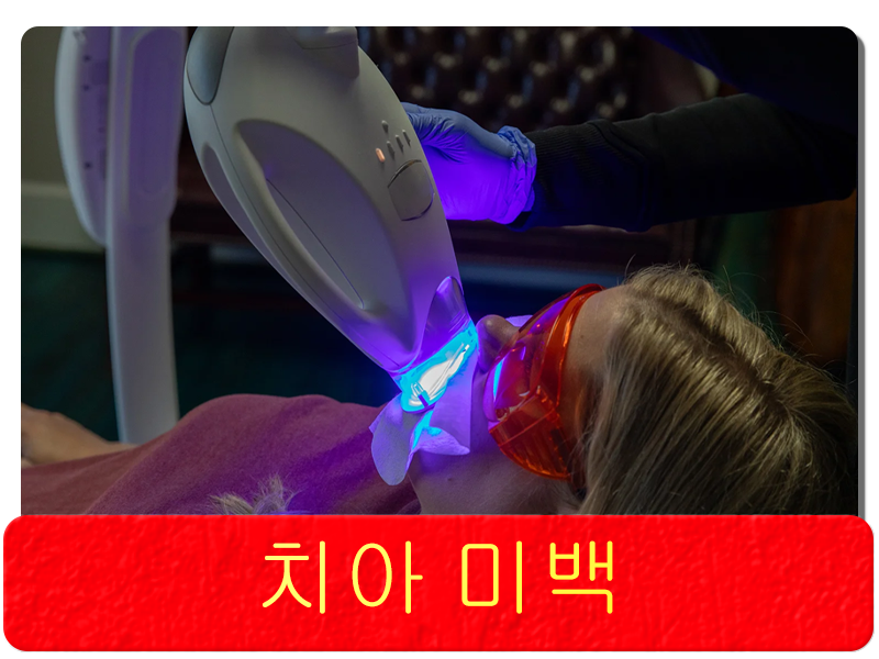 치아 미백