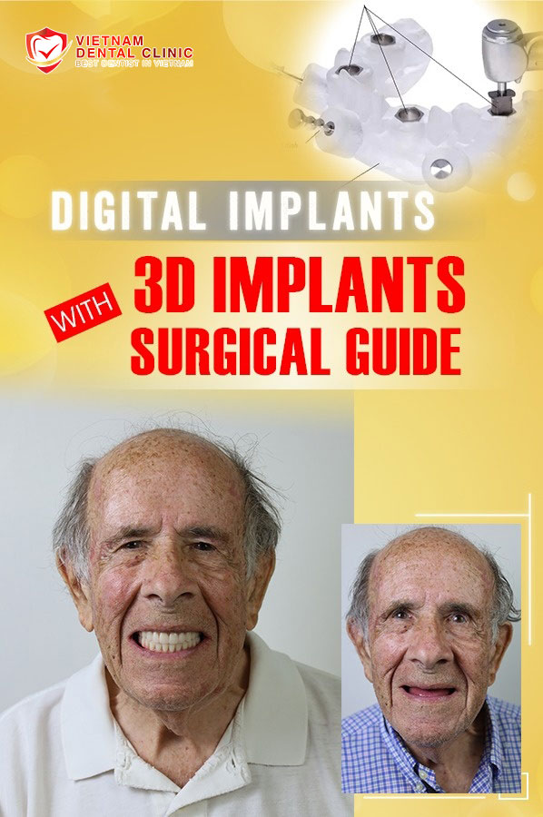 Prestigious dental implant clinic in Saigon 5