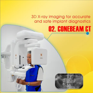 Prestigious dental implant clinic in Saigon 8