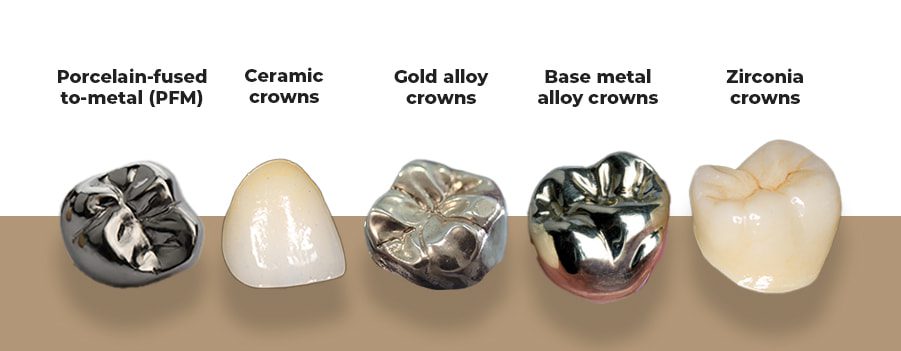 comprehensive guide to dental crowns Saigon Center Dental